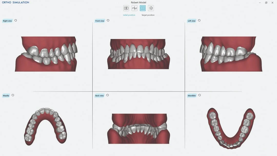 my-scan-wr-ergonomia