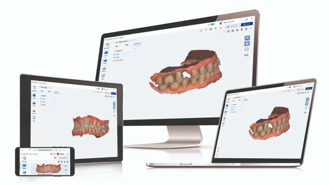 my-scan-wr-ergonomia
