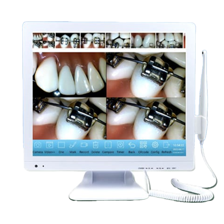 CAMARA INTRAORAL M-978 PLUS - Novatech Dental